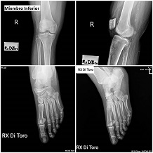Radiografías de miembro inferior: rodilla, pierna y pie