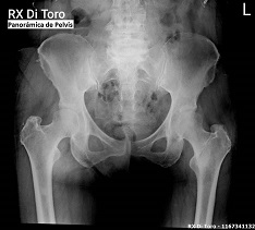 Radiografía panorámica de pelvis